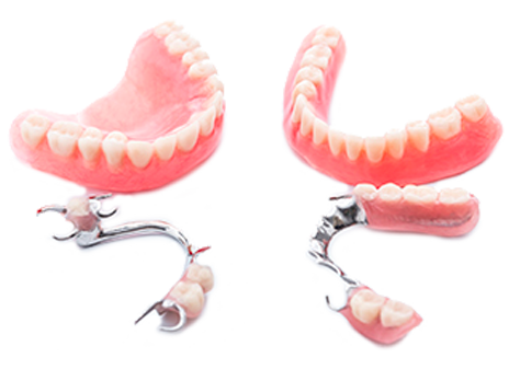 Prothèse dentaire - Espace K dentaire Villecresnes - Dentiste Villecresnes
